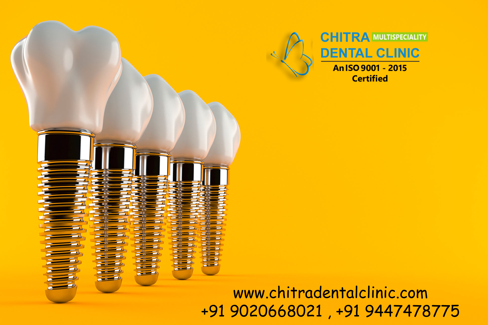 Chitra Dental Clinic in Trivandrum