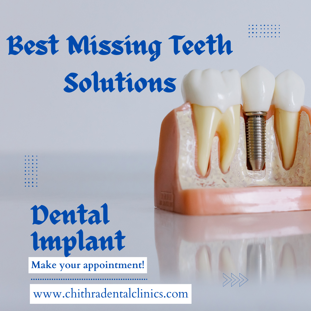 Best Dental Implant Center In Trivandrum | Restore Your Smile in One Visit!