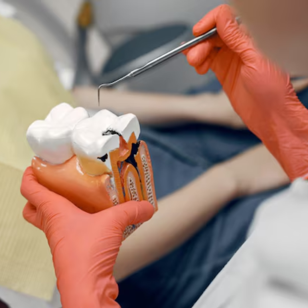 Painless Root Canal Treatment | Best Endodontic Clinic in Trivandrum