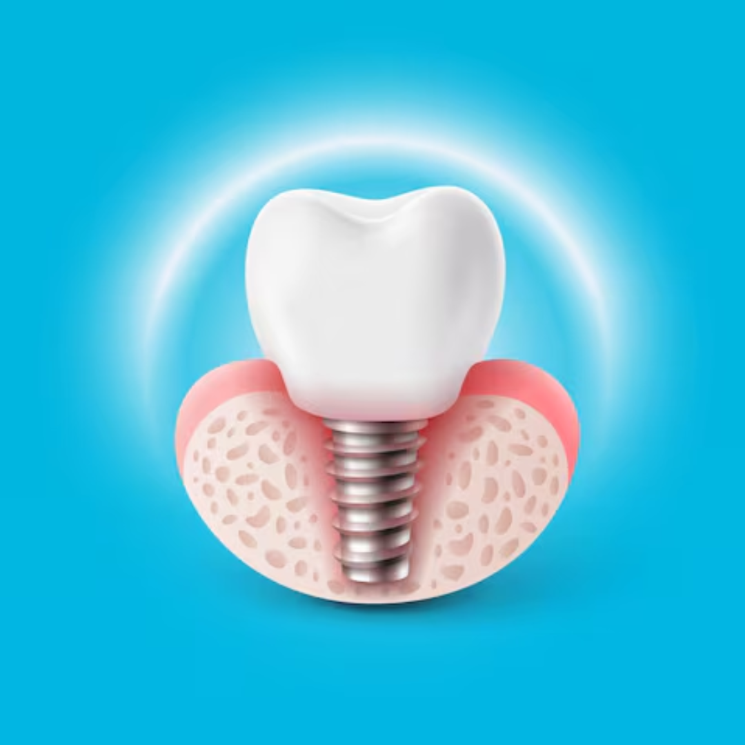 Braces or Clear Aligners? Choosing the Best Orthodontic Treatment in Trivandrum