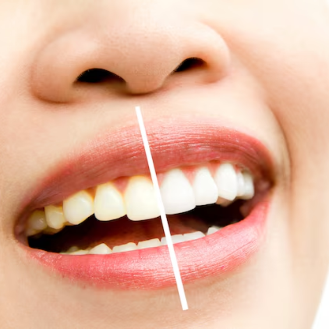 Transform Your Confidence: Why Chitra is the Best Smile Designing Clinic in Trivandrum